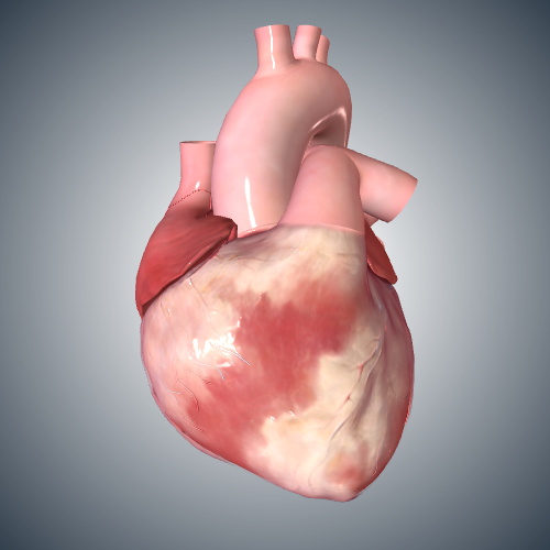 Atrial Fibrillation Cardiac Cycle