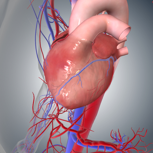 Myocardial Ischemia