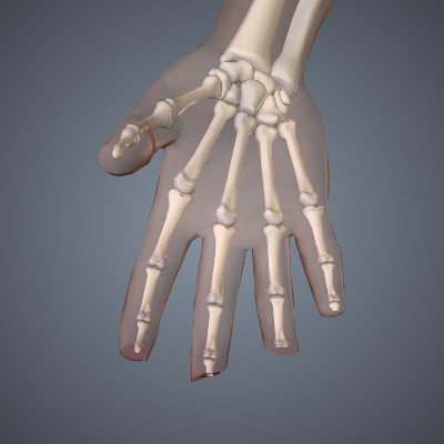 Fingertip Amputations