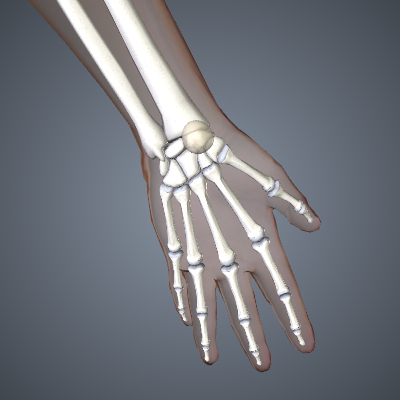 Ganglion Cyst