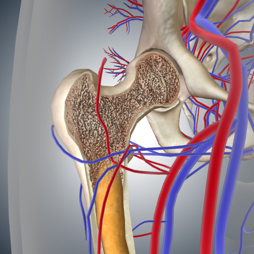 Osteoporosis in Femur