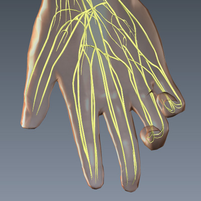 Ulnar Claw