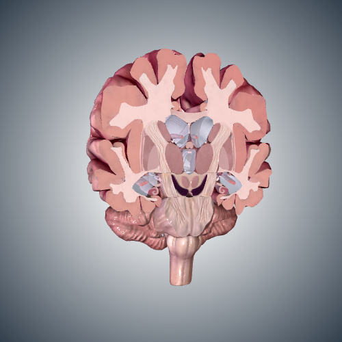 Alzheimer's Disease Brain Cross Section