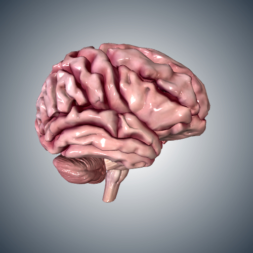 Brain with Severe Alzheimer's Disease