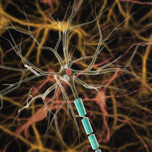 Lewy Body in Neuron