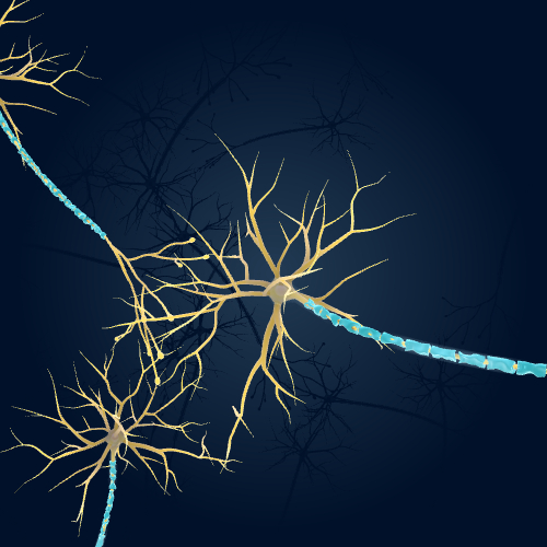 Neurons with Degenerated Myelin