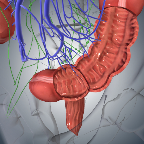 Colorectal Cancer: Stage I