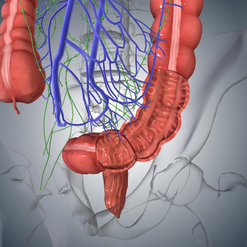 Colorectal Cancer: Stage II