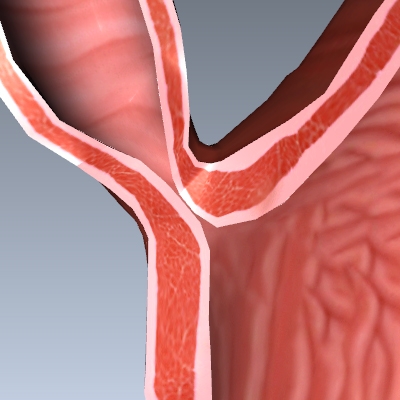 Esophageal Achalasia