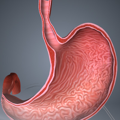 Esophageal Stricture