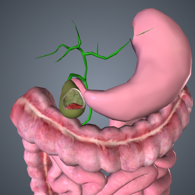 Gallbladder Cancer