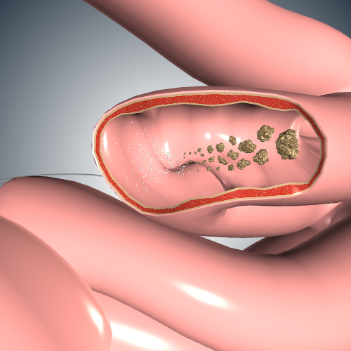 Glucose Absorption