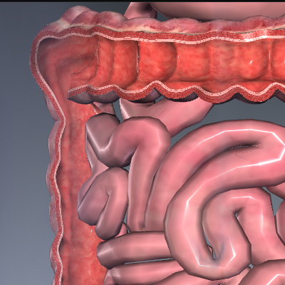 Irritable Bowel Syndrome