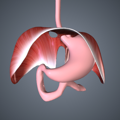 Paraesophageal Hernia