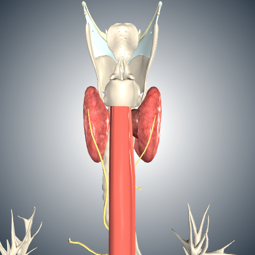 Thyroid Cancer Stage T4a - Tracheal Involvement