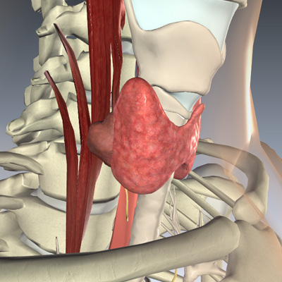 Thyroid Cancer Stage T4b