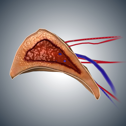 Adrenal Gland Cross Section