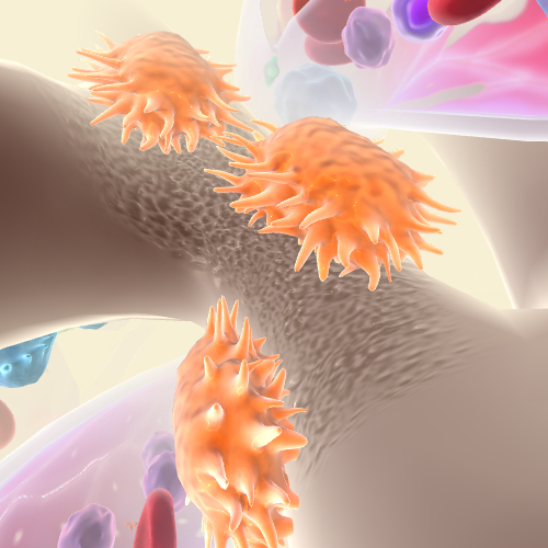 Increased Osteoclast Activity