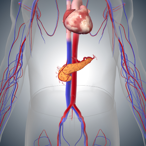 Pancreatic Cancer