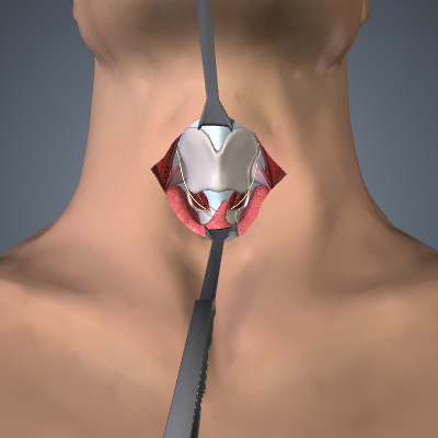 Thyroid Treatments