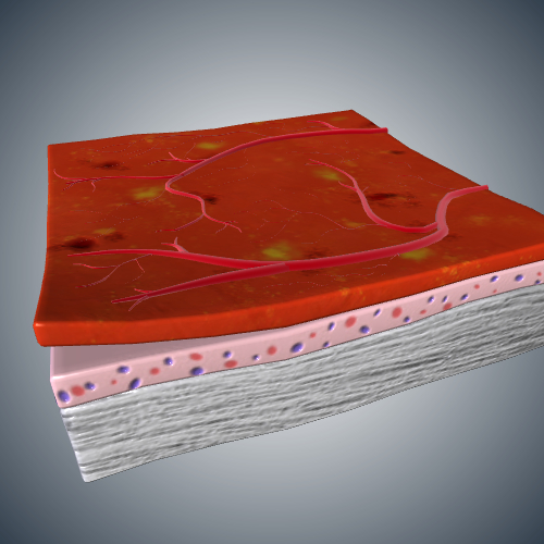 Diabetic Retina Tissue