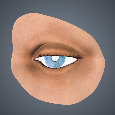 Ptosis