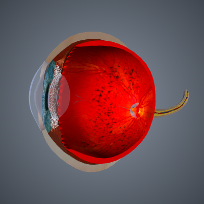 Retinitis Pigmentosa