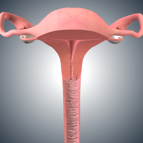 Cervical Cancer: Stage I