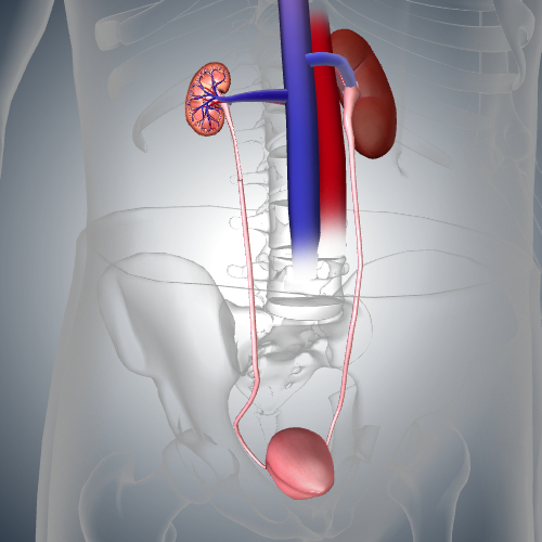 Kidney: Diseased Cross Section