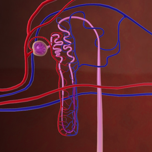 Kidney Failure in Nephron