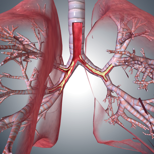 Bronchitis