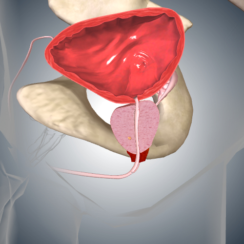 Prostate Cancer: Stage I