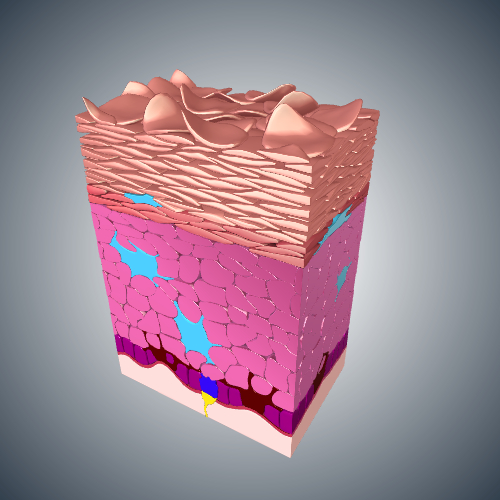 Dry Skin in Epidermis