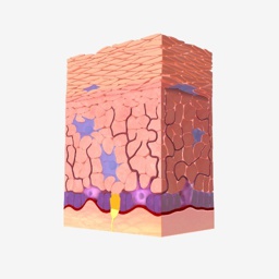 Epidermis Cell Layer - White Skin Thumbnail
