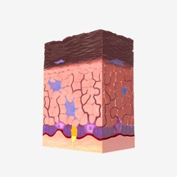 Epidermis Cell Layer - Black Skin Thumbnail