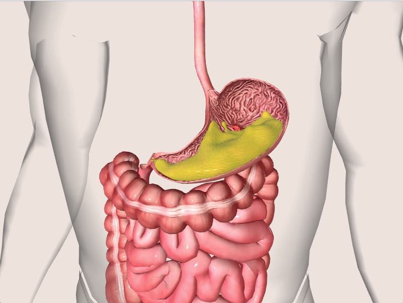 Stomach Ulcers Treatment How to Care About Them 